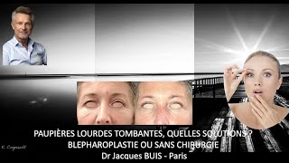 PAUPIERES LOURDES TOMBANTES  QUELLES SOLUTIONS  AVEC BLEPHAROPLASTIE OU SANS CHIRURGIE Dr BUIS J [upl. by Slyke]