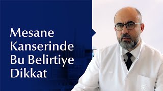 Mesane Kanseri Nedir Belirtileri Nelerdir [upl. by Yehs]