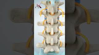 Understanding Intervertebral Discs amp Disc Herniation by Dr Abhijit Kulkarni  Brain amp Spine Surgeon [upl. by Hamas]