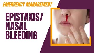 Emergency Management of Epistaxis  Nasal Bleeding Bleed through Nose [upl. by Larue]