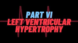 Part 6 Left Ventricular Hypertrophy [upl. by Crain]