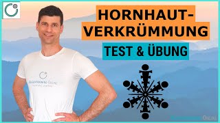 HORNHAUTVERKRÜMMUNG Wegtrainieren  Test Übung amp Training [upl. by Adnwahsor]