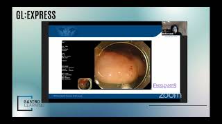 GastroLearning Express EMR Technique with Dr Noriko Suzuki [upl. by Sven451]