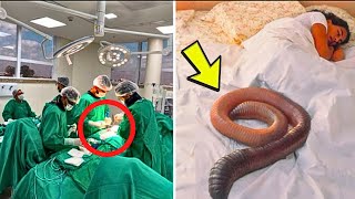 Woman Arrives at the Hospital with Stomach Pain and Doctors Panic at What Comes Out of Her Belly [upl. by Ssur]