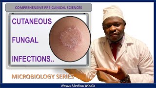 CUTANEOUS FUNGAL INFECTIONS Dermatophytoses [upl. by Strohl]