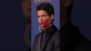 DPharaoh WoonATai’s powerful statement at the Emmys [upl. by Nyrhtakyram]