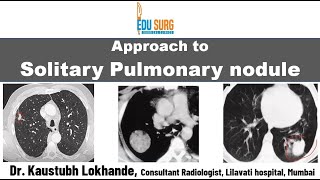 Solitary pulmonary nodule  When to suspect lung cancer  characteristics and follow up  Approach [upl. by Svetlana]