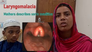 Laryngomalacia Laryngoscopy amp Clinical Feature। Natural History। Mother Describes Sons Condition [upl. by Goldina]