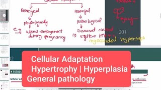 Cellular Adaptation  Hypertrophy  Hyperplasia pathology 1  First Aid USMLE Step 1 in UrduHindi [upl. by Eenahc238]