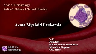 Acute Myeloid Leukemia AML  Part 1 [upl. by Atiuqehc]