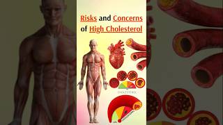 Risks and Concerns of High Cholesterol [upl. by Ardied270]