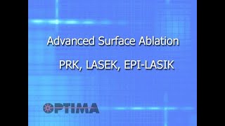 Advanced Surface Ablation – PRK LASEK EPI LASIK [upl. by Lubow]