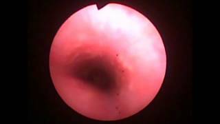 Veterinary Bronchoscopy416 Acute tracheobronchitis [upl. by Eceertal]