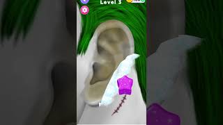 Itchy Smelly Ear Stone Removal Digging Out Super Big Earwax shorts gaming asmr [upl. by Nortal39]