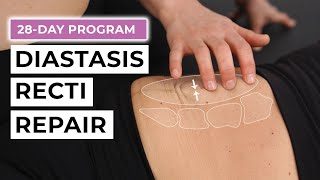 28Day Diastasis Recti Repair Program FREE Challenge [upl. by Hras408]