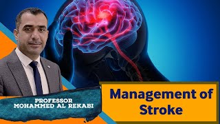 Management of Stroke [upl. by Lsil]