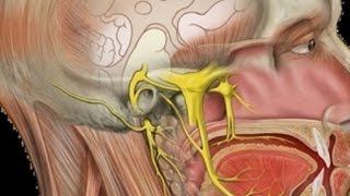 Neuralgia do Trigêmeo  Dores na Face Tratamentos para Nevralgia do Nervo Trigêmeo [upl. by Egreog]