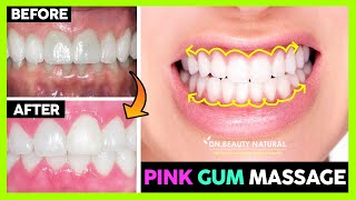 😁 How to Get Pink Gums with Massage  Black Gums to Pink Gums  Healthy Pink Gums Home Remedy [upl. by Akemet]