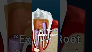 Get Relief Now Expert Root Canal Treatment at Partha Dental [upl. by Yeta]