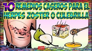 Culebrilla Tratamiento Natural  10 Remedios Caseros para el Herpes Zoster o Culebrilla👩‍🔬 [upl. by Helge]