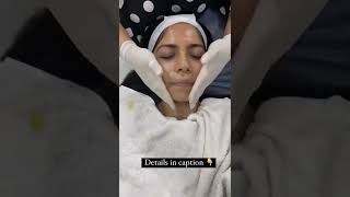 I tried a Yellow PeelChemical Peel for my skin chemicalpeel skincare ashortaday [upl. by Whipple]