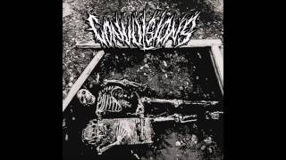 Convulsions  ST EP 2016 Full Album HQ Grindcore [upl. by Akital]