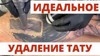 ИДЕАЛЬНОЕ УДАЛЕНИЕ ТАТУ лазером за 5 МЛН РУБЛЕЙ ПРАВИЛЬНОЕ лазерное удаление [upl. by Farrand190]