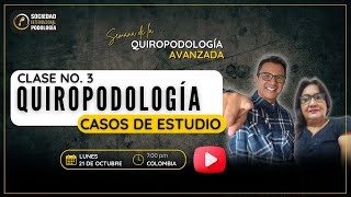 Quiropodologia casos de estudio 3 [upl. by Ong]