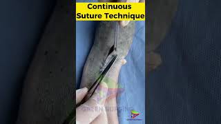 Continuous Suture Technique sutures surgery surgicalsuture [upl. by Macmullin]