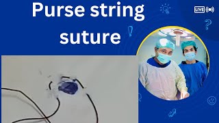 purse string suture  suture techniques and uses [upl. by Maya372]