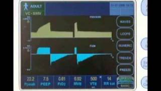 Newport e360 Ventilator Overview [upl. by Nhor]