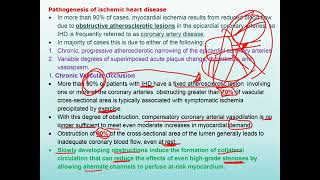 ischaemic heart disease [upl. by Stewardson726]