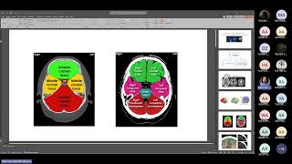 Radiological Anatomy of the CNS by Dr Moustafa Alhassan [upl. by Mackay]