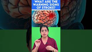 ⚠️Warning signs of stroke🧠 [upl. by Liatrice]