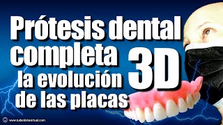 La FORMA mas ECONÓMICA para REEMPLAZAR TODOS los DIENTES en la ACTUALIDAD prótesis completa o total [upl. by Lednem69]