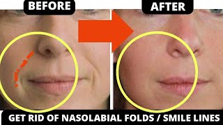 FACE MASSAGE TO REMOVE SMILE LINES NASOLABIAL FOLDS SAGGY SKIN JOWLS FOREHEAD LIFT CHEEKS [upl. by Threlkeld457]