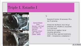 TRIPLE I INFLAMACION INFECCION INTRAUTERINA [upl. by Janyte]