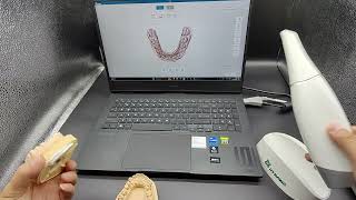 How to use intraoral scanner correctly [upl. by Polivy]