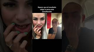 Cambió sus dientes por unas teclas de piano 😭 [upl. by Daniel]