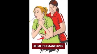 HEIMLICH MANEUVER  ABDOMINAL THRUSTS  Heimlich Maneuver in Adult Child Infant Pregnant amp Obese [upl. by Ecnaralc524]