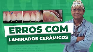 Os erros mais comuns com laminados cerâmicos [upl. by Nymrak504]