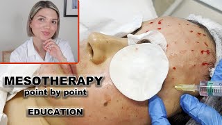 Mesotherapy for face full demo and point by point injection technique [upl. by Piwowar657]