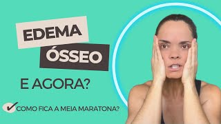 Edema ósseo e Corrida  Como Fica a Minha Meia Maratona [upl. by Faria266]