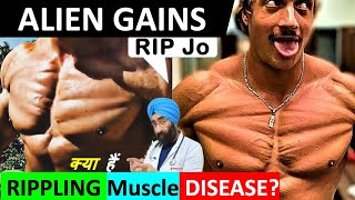 What are Alien Gains  क्या हैं Rippling muscle disease  RIP Jo aesthetics  DrEducation [upl. by Mildrid579]