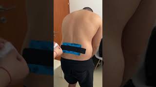 Kinesio taping for low back pain kinesiotape lowbackpainrelief Talsadeh backpaintreatment [upl. by Enyrhtak]