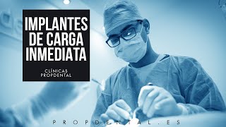 Cirugía de la colocación de implantes carga inmediata [upl. by Suaeddaht]