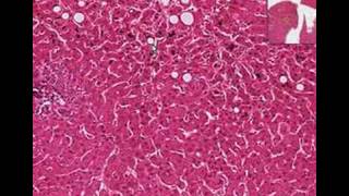 Histopathology LiverCholestasis [upl. by Esinej928]