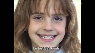 VOSTFR Emma Watson essaye les fausses dents dHermione Granger 2000 [upl. by Pyne]