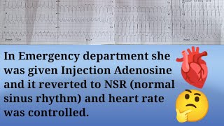 SVT Supraventricular Tachycardia ECG interpretation made easy ecg cardiology [upl. by Alrahs]