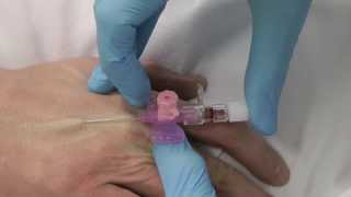 Cannulation How to insert a cannula One Minute Edition Medicine in a Nutshell IV Access [upl. by Reddin]